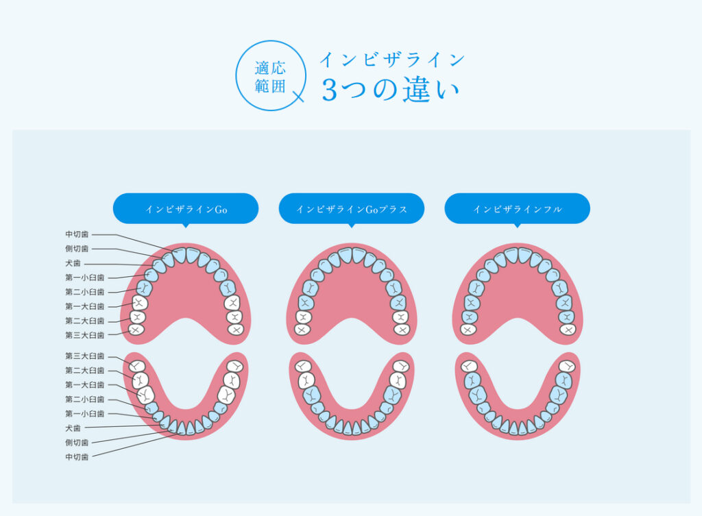 インビザライン３つの違い