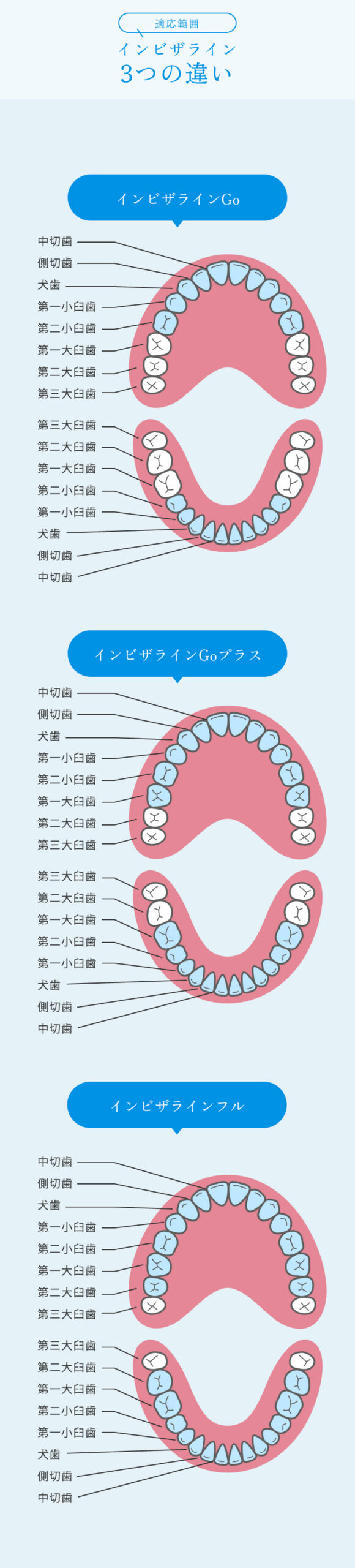 インビザライン３つの違い