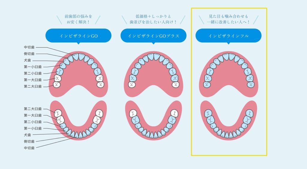 インビザラインフル